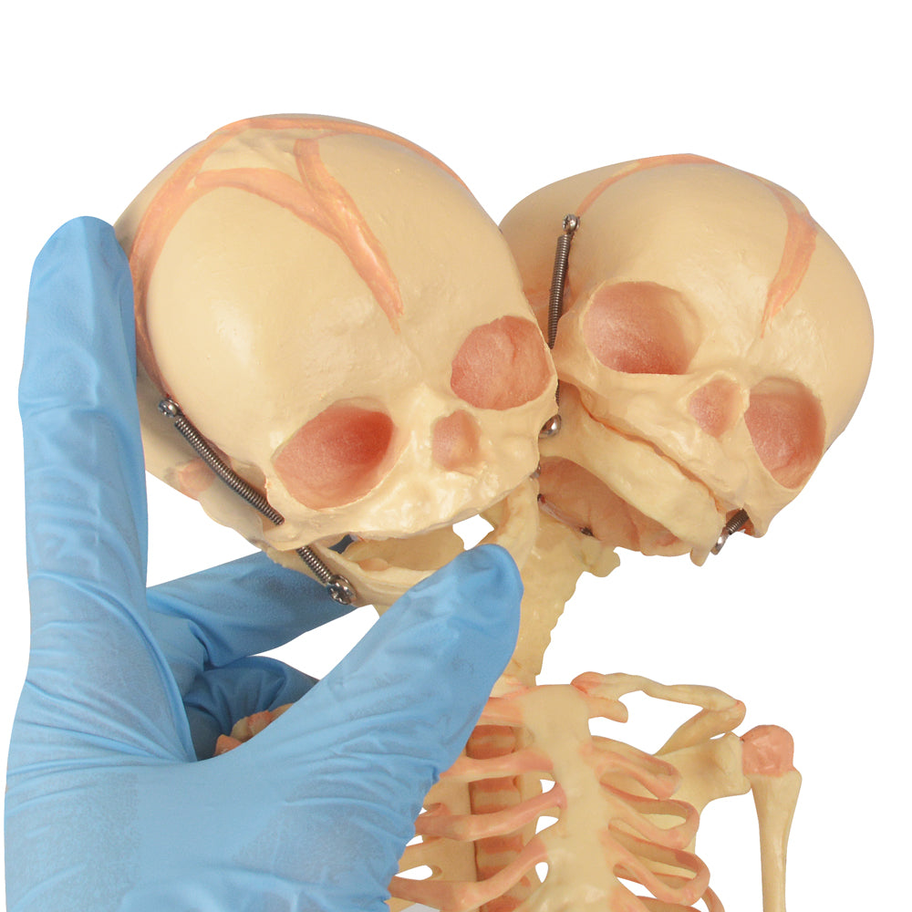Twin-Head Human Fetus Skeleton Model
