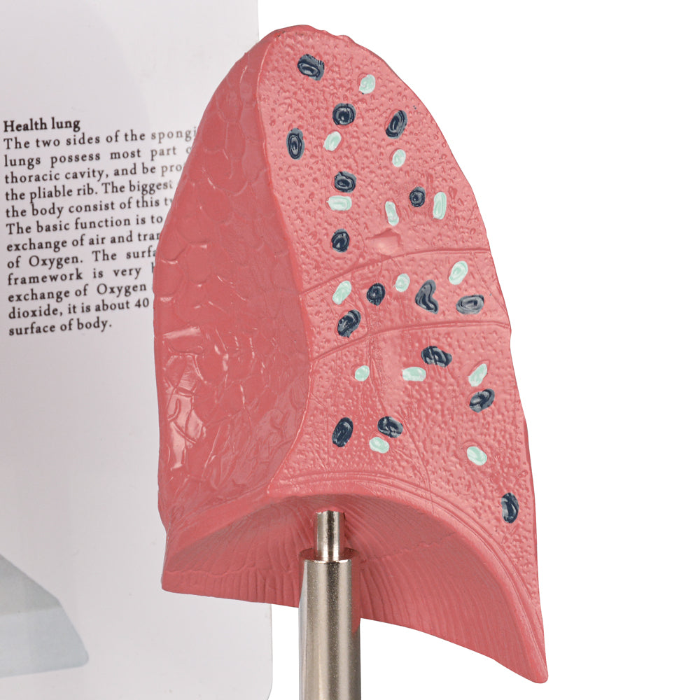 Healthy vs Smoker’s Lungs Comparison Display Model