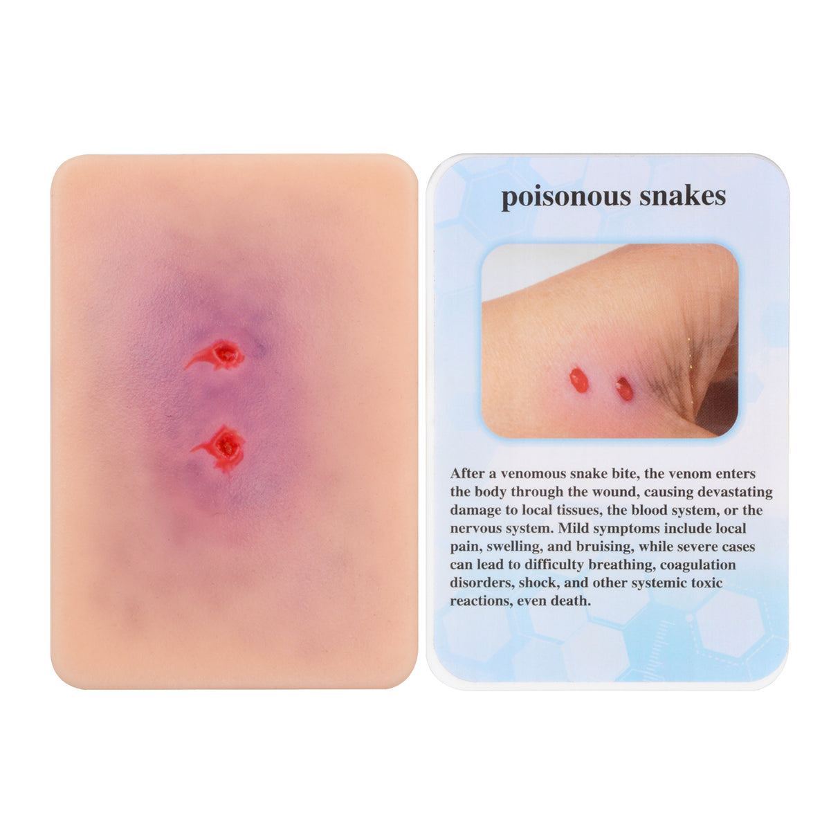 Poisonous Snakes Bite Wound Simulation Moulage