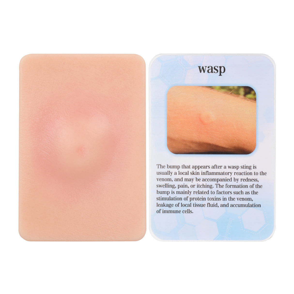 Wasp Sting Wound Simulation Moulage