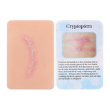 Cryptoptera Wound Simulation Moulage