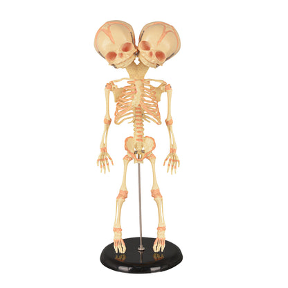 Twin-Head Human Fetus Skeleton Model