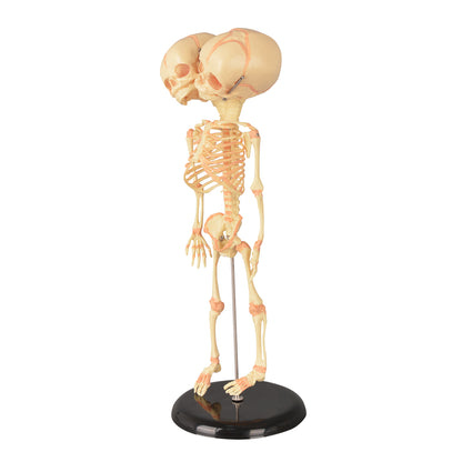 Twin-Head Human Fetus Skeleton Model