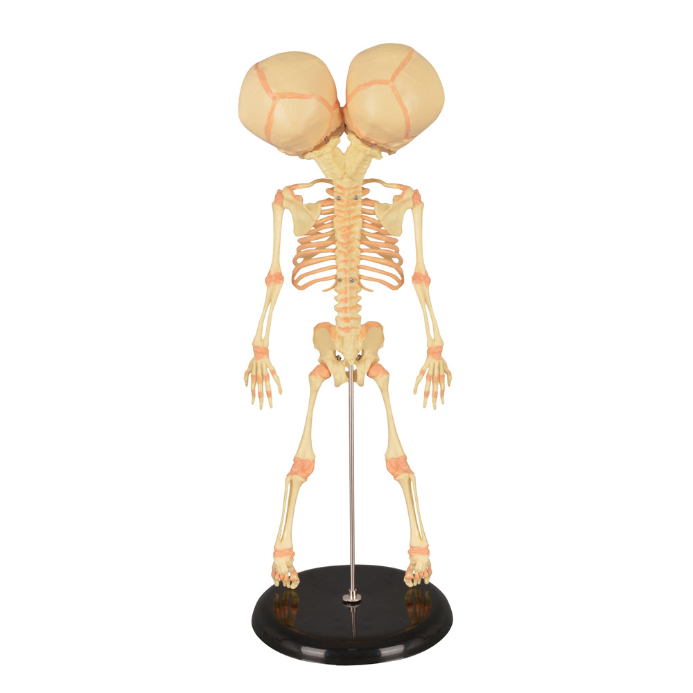 Twin-Head Human Fetus Skeleton Model