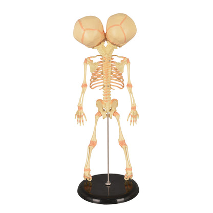 Twin-Head Human Fetus Skeleton Model