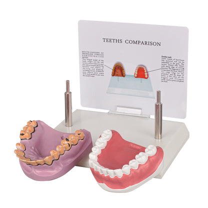 Healthy vs Smoker’s Mouth Comparison Model