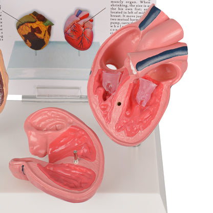 Healthy vs Smoker’s Heart Comparison Model