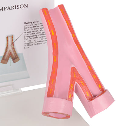 Healthy vs Smoker’s Vessels Comparison Model