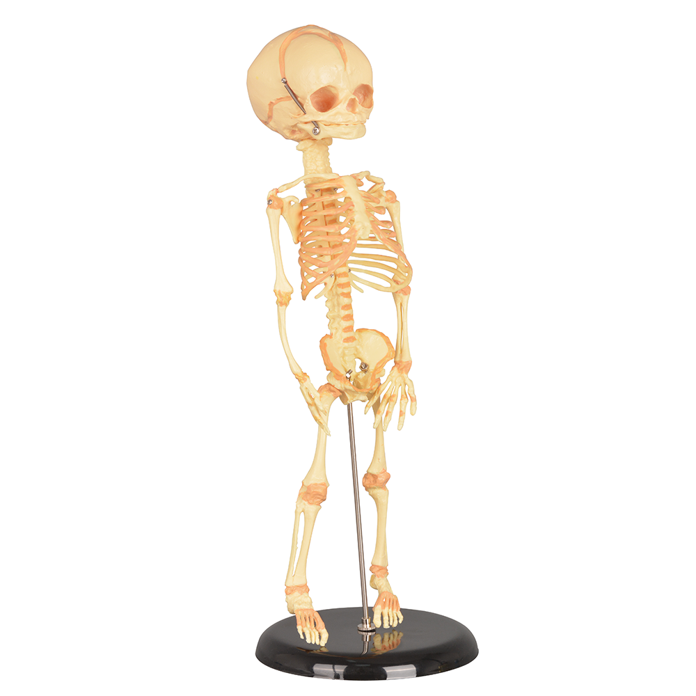 Single-Head Infant Human Skeleton Model for Medical Antomy Education