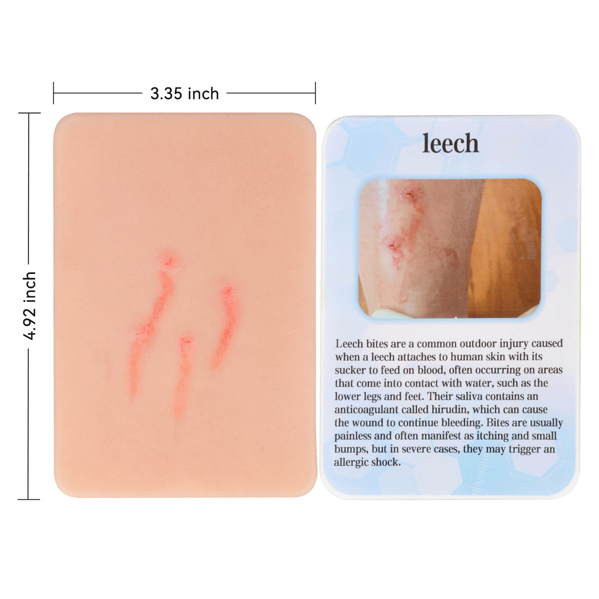 Leech Bite Wound Simulation Moulage