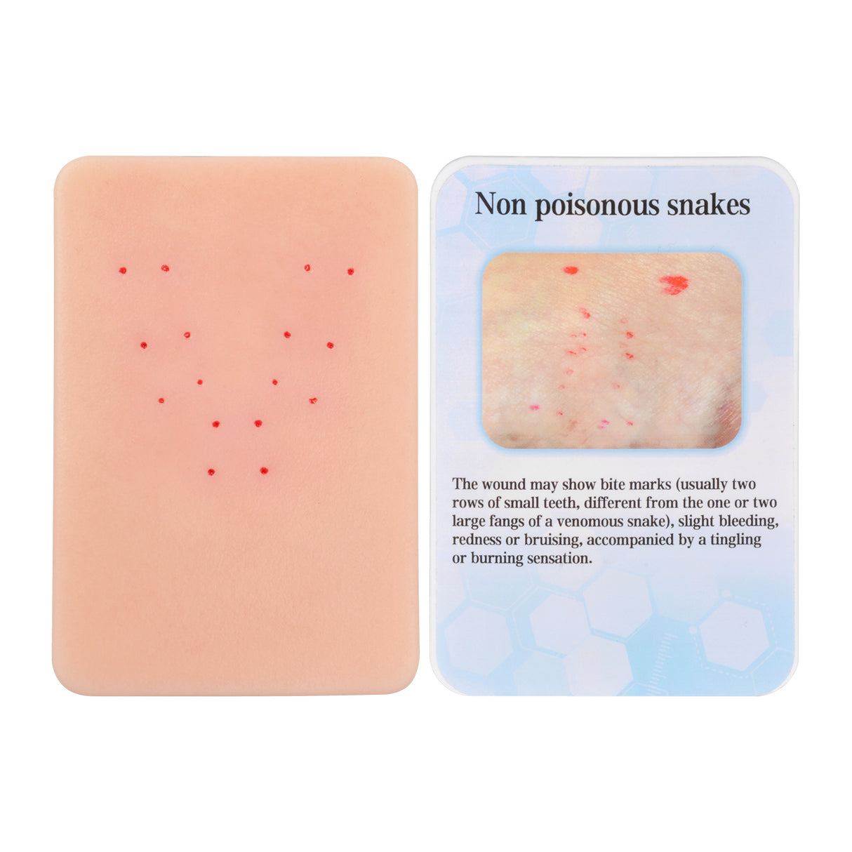 Non Poisonous Snakes Bite Wound Simulation Moulage